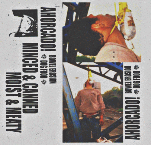 Bowel Erosion : Ahorcado!